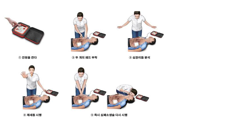 자동제세동기